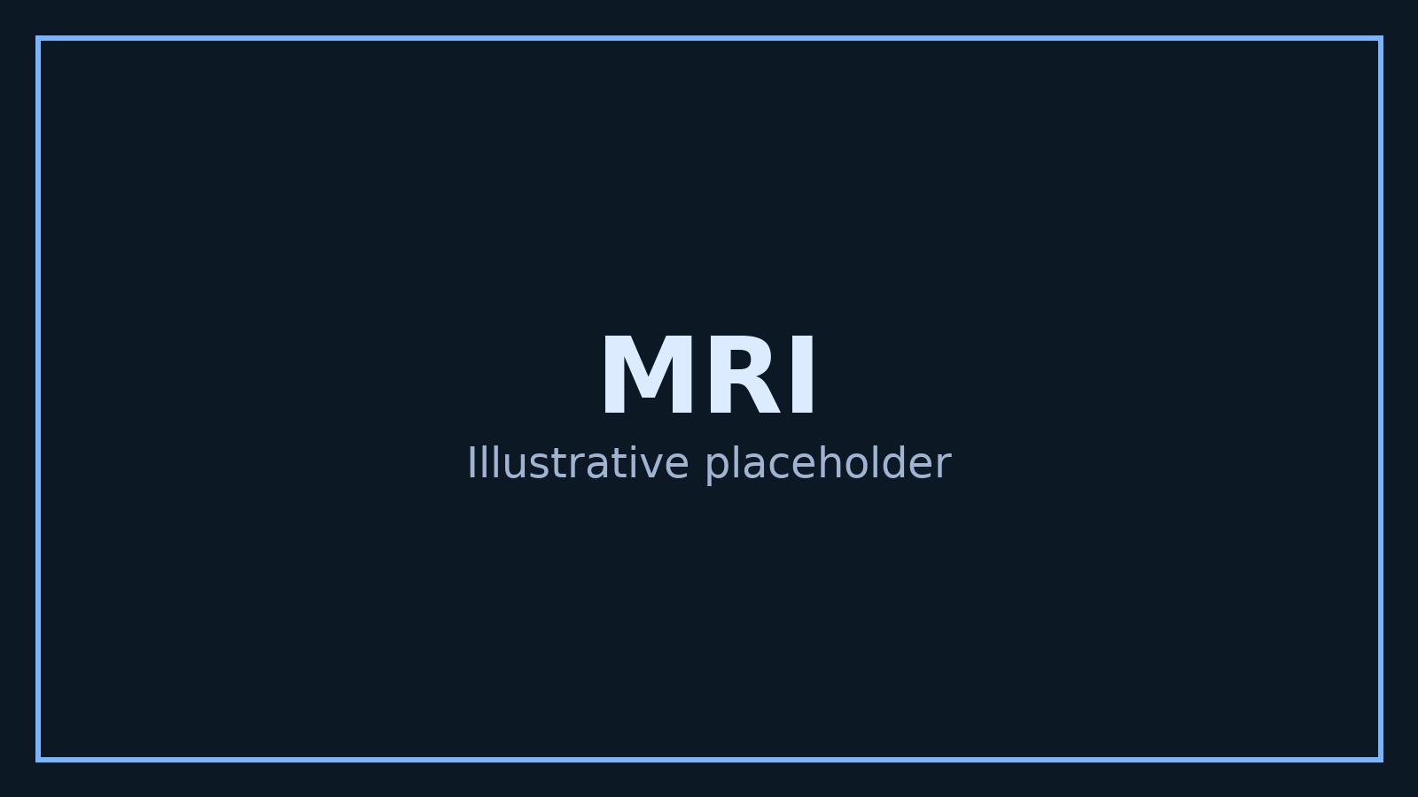MRI example image