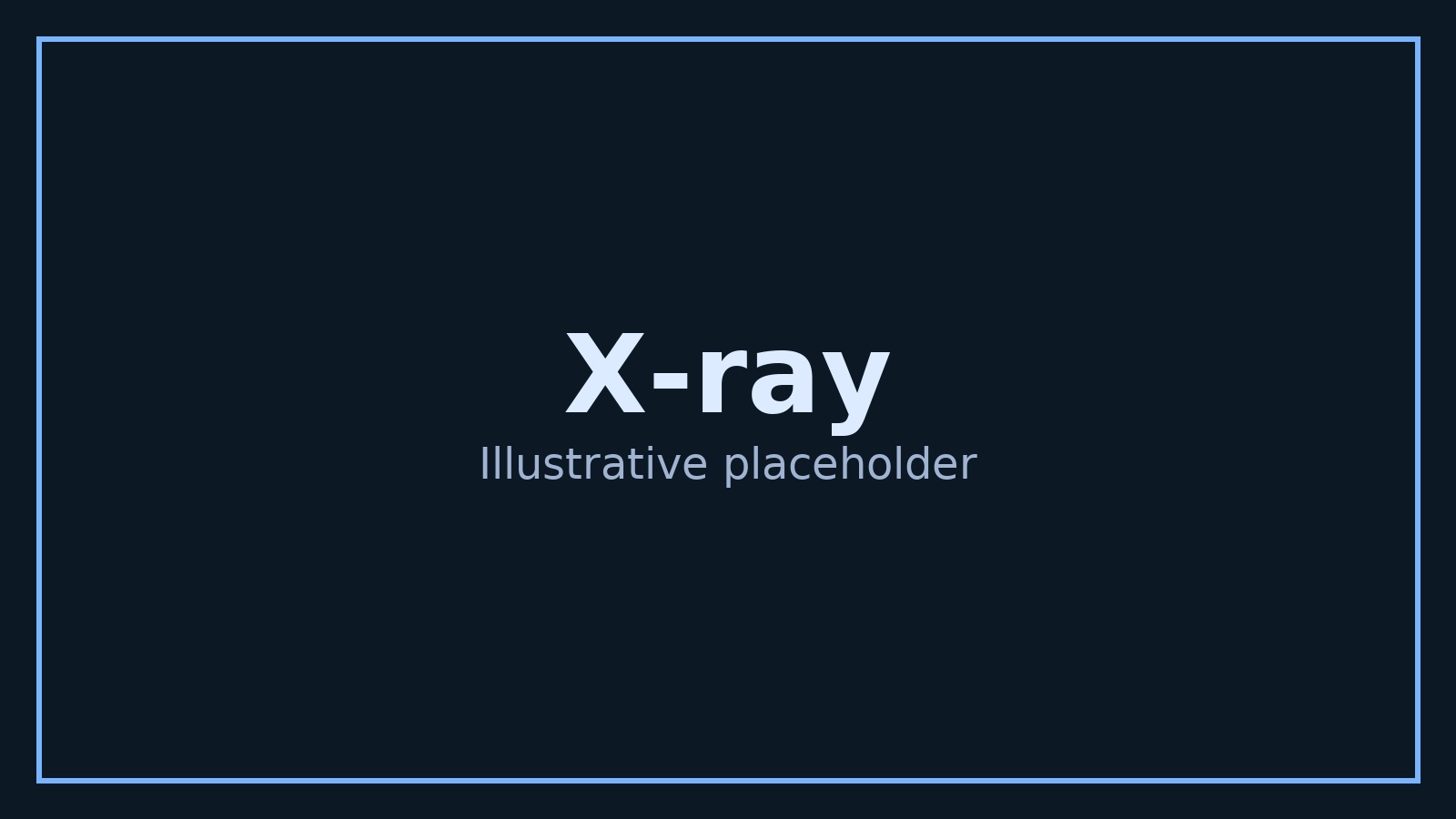 X-ray example image